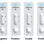 Contoh Surat Rapid Test Antigen: Panduan Lengkap dengan Format dan Prosedur