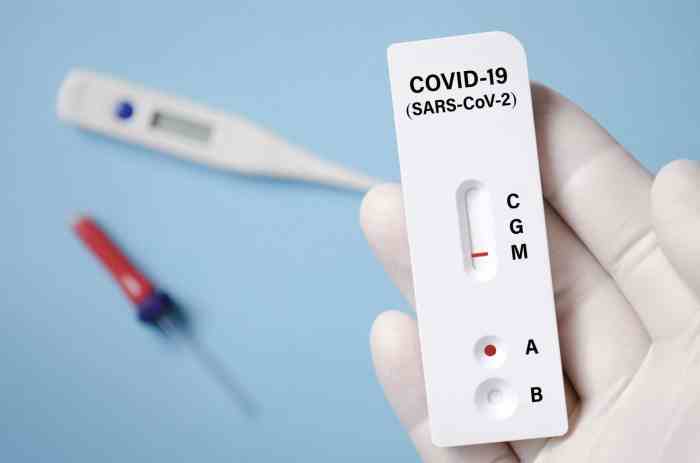 Contoh Surat Rapid Test Antigen: Panduan Lengkap dengan Format dan Prosedur